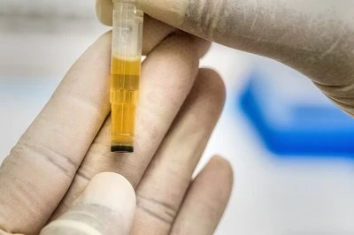 Технологія Microneedle: піднімаємо хрест{0}}інтерфейсну завісу біомедичної ін...